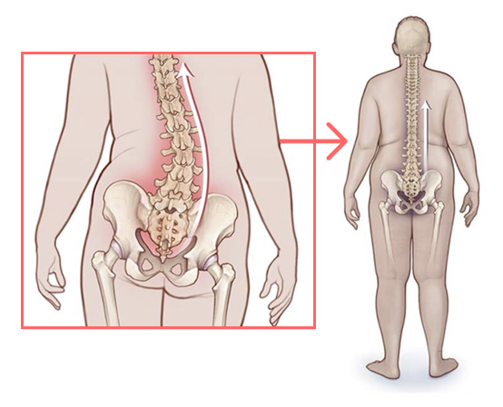 교정도수치료 대표이미지