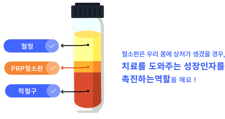 줄기세포 PRP 재생 치료 대표이미지