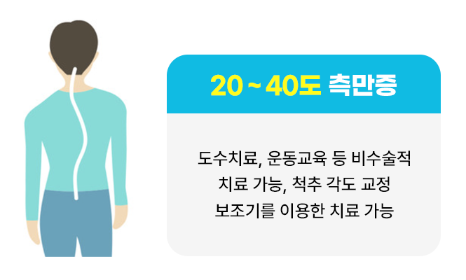 20~40도 측만증 : 도수치료, 운동 교육 등 비수술 적 치료 가능