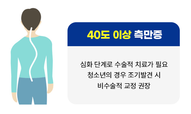 40도 이상 측만증 : 심화단계로 수술척 치료가 필요ㅅt